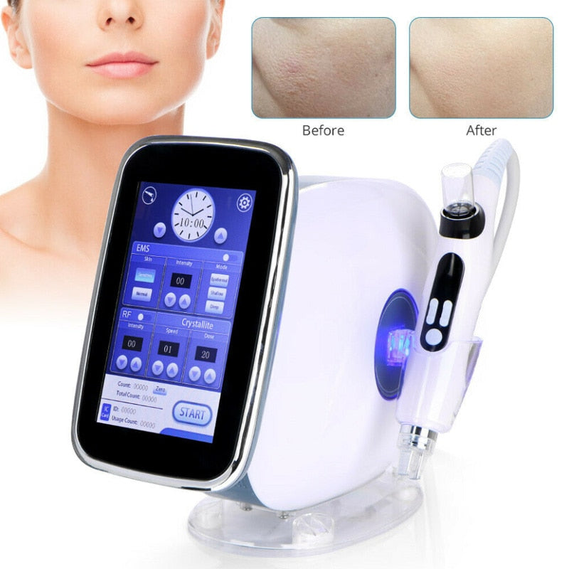 Microneedle Mesotherapy Machine - EMS Face Mesotherapy Machine - RF Radio Frequency No-Pain Anti Aging Photon Skin Care - Beauty Instrument